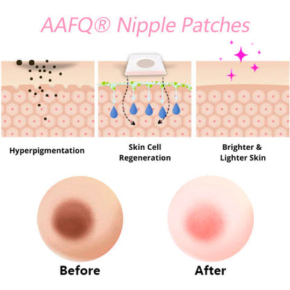 AAFQ® 𝐏𝐥𝐮𝐦𝐩 𝐮𝐩 & Tighten Skin & Soft & 𝐏𝐢𝐧𝐤𝐢𝐟𝐲 𝐍𝐢𝐩𝐩𝐥𝐞 Patches